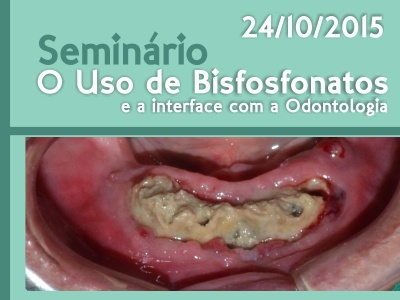 Seminário: O uso de Bisfosfonatos e a interface com a Odontologia